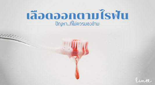 เลือดออกตามไรฟัน ปัญหาที่ไม่ควรมองข้าม