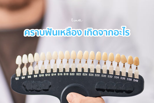 คราบเหลืองที่ฟันเกิดจากอะไร