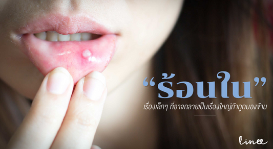 “แผลร้อนใน” เรื่องเล็ก ๆ ที่อาจกลายเป็นเรื่องใหญ่ถ้าถูกมองข้าม