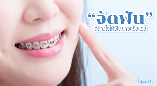 "จัดฟัน" อย่างไรให้ "ฟันขาว" แข็งแรง