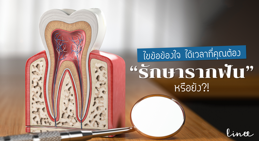 ไขข้อข้องใจ ได้เวลาที่คุณต้องรักษารากฟันแล้วหรือยัง ?!