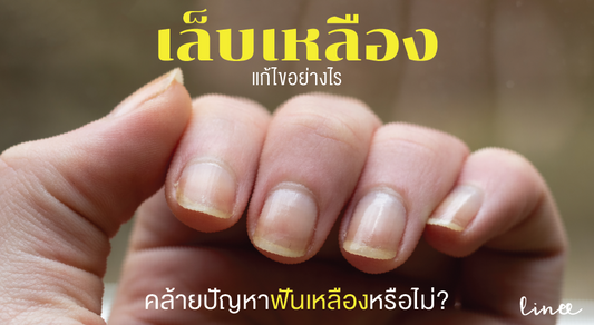 เล็บเหลือง แก้ไขอย่างไร คล้ายปัญหาฟันเหลืองหรือไม่ ?