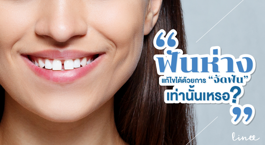 "ฟันห่าง" แก้ไขได้ ด้วยการ "จัดฟัน" เท่านั้น ใช่หรือไม่ ?