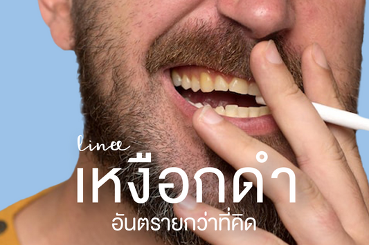 เหงือกดำ อันตรายกว่าที่คิด!